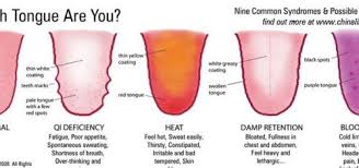 tcm tongue chart reading your health through your tongue