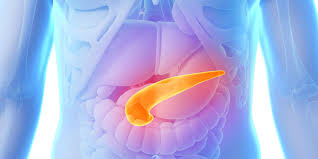 Unlike breast, colon, and prostate cancers, pancreatic cancer isn't routinely found with screening tests. Do You Know The Symptoms Of Pancreatic Cancer