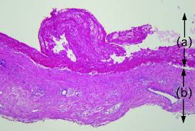 Image result for Pseudoeriosema
