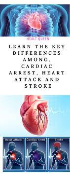 Learn The Key Differences Among Cardiac Arrest Heart Attack And Stroke Heart Attack Cardiac Arrest Heart Attack Treatment