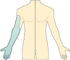 Image result for Axillary Nerve Block