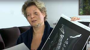 We did not find results for: What Happened To Joice Hasselmann What Is Known About Attack