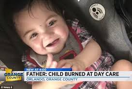 Father Demands Answers After Child Suffers Horrific Burns At Daycare Express Digest