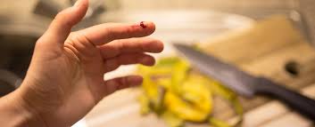 Wann ist eine schnittwunde ein fall für den arzt? Schnittverletzung Und Jetzt Betadona