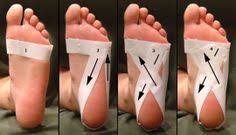 Foot Taping For Plantar Fasciitis Wrap Strip Around Foot At Level Of Ball Of Foot 2nd Plantar Fasciitis Plantar Fasciitis Taping Plantar Fasciitis Treatment