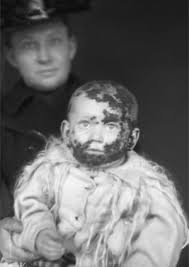 Image result for Colletoecema