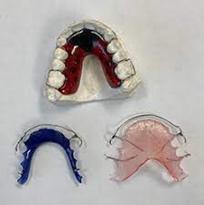 These can come in a variety of colors, and can even have designs on the acrylic palate piece. Retainer Types And Cleaning Braces San Diego San Diego La Jolla Ca