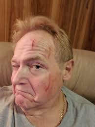 Upgrading or replacing a 66 sprite harness