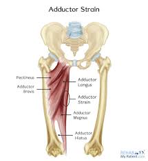 Hip abduction exercises strengthen the muscles that stabilize your femur. Hip Adductor Strain Rehab My Patient