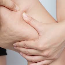 Während der anwendung des produkts ist es besser, das auftragen der creme auf die unteren extremitäten zu vermeiden, wo ausgeprägte anzeichen von krampfadern vorliegen. Weyergans High Care Cosmetics Differenzierte Cellulite Behandlung