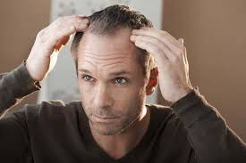 Wavy hairstyles can not be appropriate for middle part hair with short forehead because outstanding hair waves will make the face and short forehead get more attention. 43 Best Haircuts And Hairstyles For Balding Men In 2021