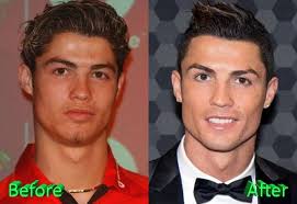 Cristiano Ronaldo S Before And After Plastic Surgery Photos Are Extremely Different Good Books Plastic Surgery Photos Plastic Surgery Ronaldo