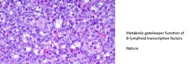 Check spelling or type a new query. Relacion Entre Glucosa Y La Leucemia Linfoblastica Aguda De Celulas B Centro De Investigacion Del Cancer Comprehensive Cancer Center Research