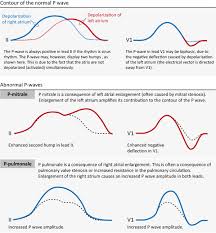 Ecg Interpretation Characteristics Of The Normal Ecg P