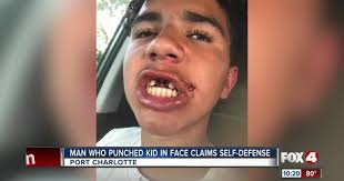 Mom Upset No Arrest After Man Punches Her Kid