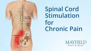 Cincinnati Spine Surgery Center Mayfield Spine Surgery Center Laser Spine Surgery Alternatives