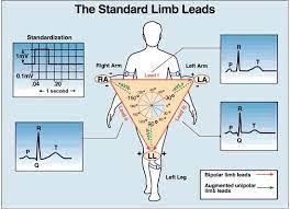 Even though two electrodes are used, only the actual potential under. Ecg Learning Center An Introduction To Clinical Electrocardiography