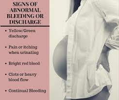 Bossier city, la, united states 314 posts. An Explanation Of Bleeding Spotting During Pregnancy Wehavekids