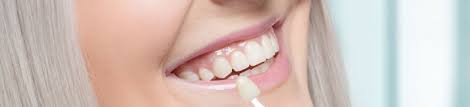 Veneers Kosten Mit Einer Zahnzusatzversicherung Abdecken