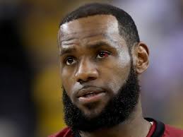 NBA Finals: Why Is LeBron James's Eye Still Red After Game 2?