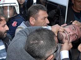 Maybe you would like to learn more about one of these? Suruc Ta Hayatini Kaybedenlerin Yurek Burkan Hikayeleri Ntv