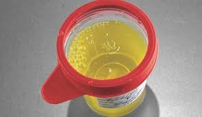 We did not find results for: 10 Arti Warna Air Urine Terhadap Kesehatanmu Apakah Kamu Cukup Minum