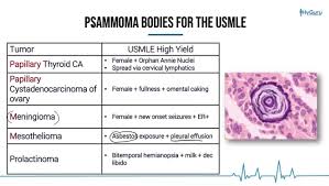 Epidemiology incidence ~3,000 cases diagnosed/year in the us; Hyguru Posts Facebook