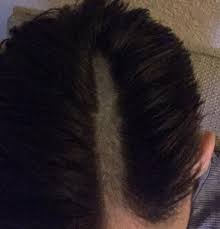 We did not find results for: 20 Fatal Haircuts That Prove A Bald Head Is Sometimes Not That Bad