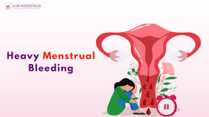 Image result for Menstrual Bleeding