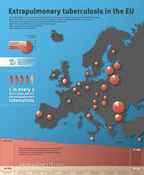 Image result for Extrapulmonary Tuberculosis