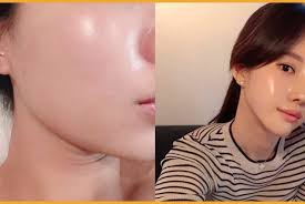Epingle Sur Soins