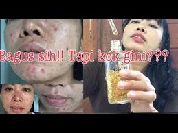 Whitening serum gold jaya mandiri asli tidak mengandung bahan kimia yang membahayakan seperti mercury dan hydroquinone yang bisa merusak kulit wajah. Tertipu Serum Pemutih Palsu Goldzan 24k Wajah Penuh Jerawat Batu Youtube