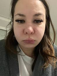 What help and guidance is available for newly diagnosed lupus patients?