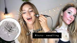 Ich habe ein herz für familienunternehmen und menschen, die aus ihrer leidenschaft einen beruf machen. Micro Needling Fur Zuhause Youtube