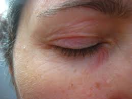 What S Wrong With My Skin No Nonsense Beauty Blogno Nonsense Beauty Blog