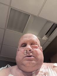 Poor medical treatment at St Rita's hospital in Lima, Ohio