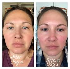 Tre Skin Aloe Vera Skin Care Healthy Skin Care Natural Skin Care