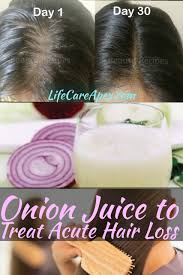 Sulfur is also found in keratin, which is one of the components of hair. Pin On Hairstyle