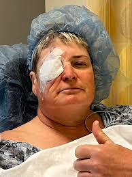 Driving, while I still can, in the daytime, as my vision is 20/60 in my  remaining eye. I swear the visual field spot is getting bigger in my  injured eye. So confusing,