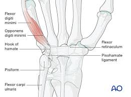 Image result for Hamate Bone