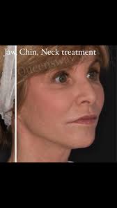 GET THE VOW FACTOR 👰🏼‍♀️🕊️ Some of our beautiful brides who have visited  Queensway Skin Clinic in preparation for their big day. Let us be a part of  your love story and