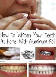 We did not find results for: Teeth Whitening
