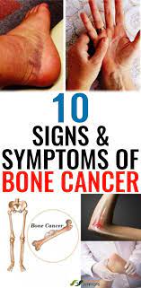 Bone cancer signs and symptoms. What Are Some Signs Of Bone Cancer