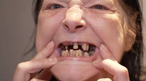 65-årig kvinde lever af mos