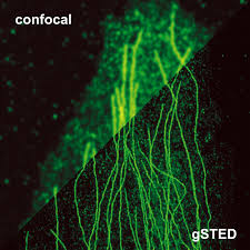 We offer a range of systems from microscopes for . Stimulated Emission Depletion Microscopy Sted Picoquant