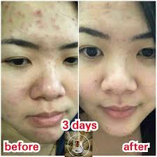Free shipping on prepaid orders over rs.699. Eses Pearl Cream From Korea çç è† 15g æŠ¤è‚¤ç¾Žè‚Œ æŠ¤è‚¤ä¿å…» æ¬¢è¿Žå…‰ä¸´pretty Princess Onlineshop é©¬æ¥è¥¿äºšçŽ°è´§è´­ç‰©ç½' æ¯å¤©24å°æ—¶æŽ¥ç•™è¨€ è®¢å• Powered By 1maxhostingenterprise