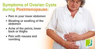 Vaginal bleeding after the menopause. Pin On 34 Menopause Symptoms