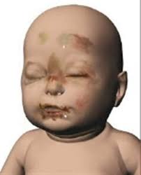 Foster mum's fears for a Baby P case in Kent