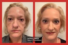 All About Injectables, Local Nurse Practitioner's New Book Aims To Educate  You