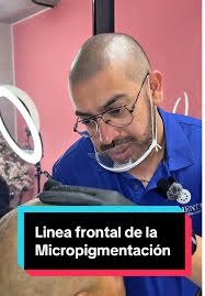 Casos Reales de Micropigmentación Capilar